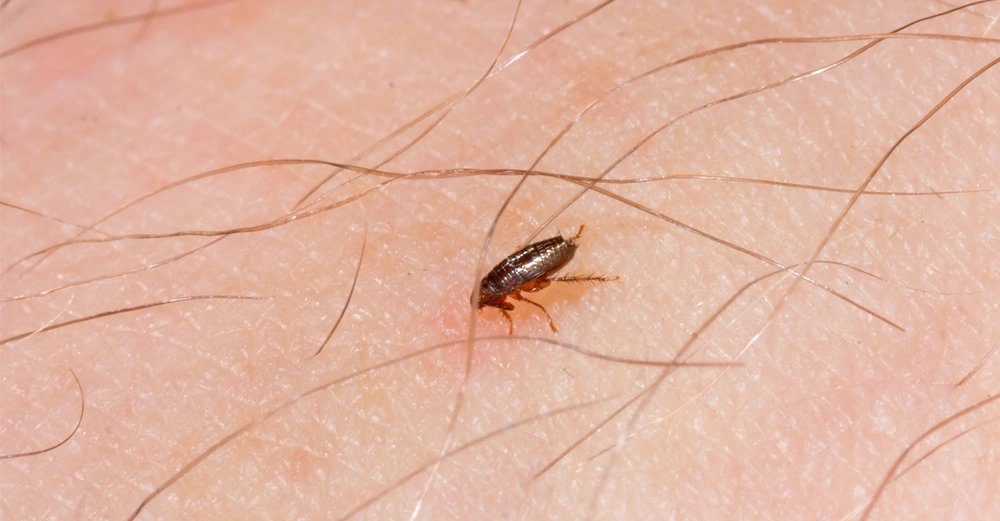 einzelner Floh krabbelt über behaarte Menschenhaut, Großaufnahme.